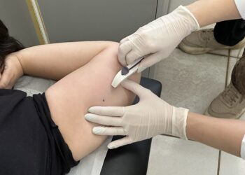 Americana terá mutirão gratuito de Implanon com 750 implantes; veja quem pode participar e os locais