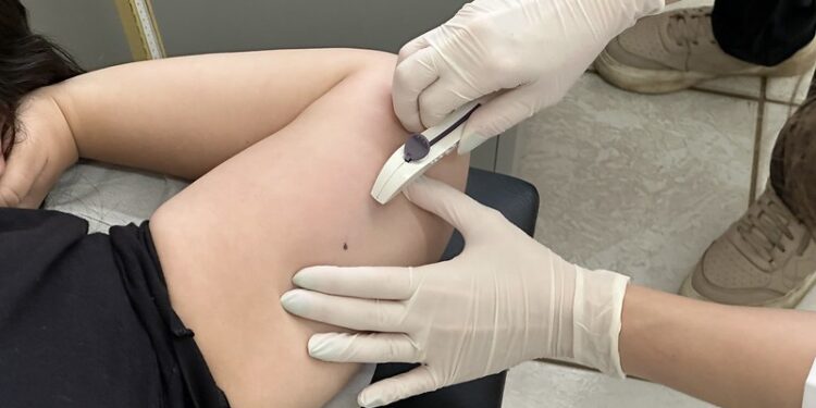 Americana terá mutirão gratuito de Implanon com 750 implantes; veja quem pode participar e os locais