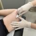 Americana terá mutirão gratuito de Implanon com 750 implantes; veja quem pode participar e os locais